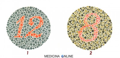 medicina-online-tavole-di-ishihara-test-daltonismo-tavole-1-2.jpg